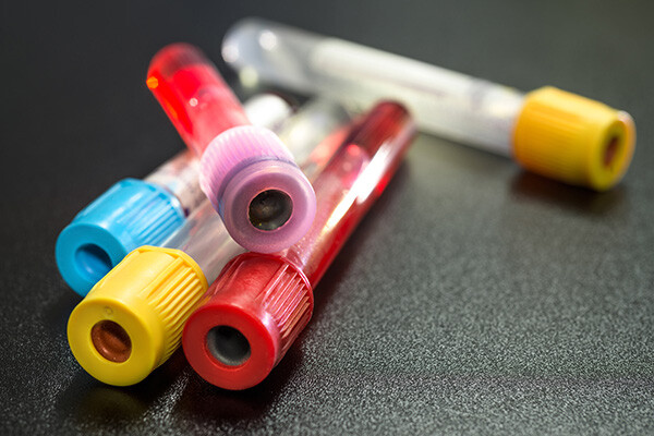 Important changes to routine and non-urgent blood test appointments